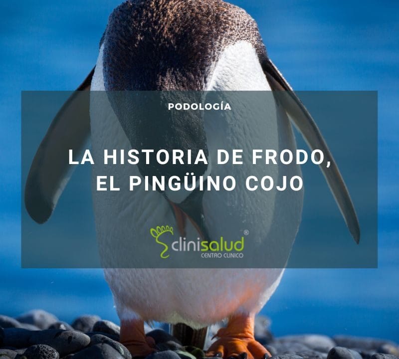 frodo pingüino cojo