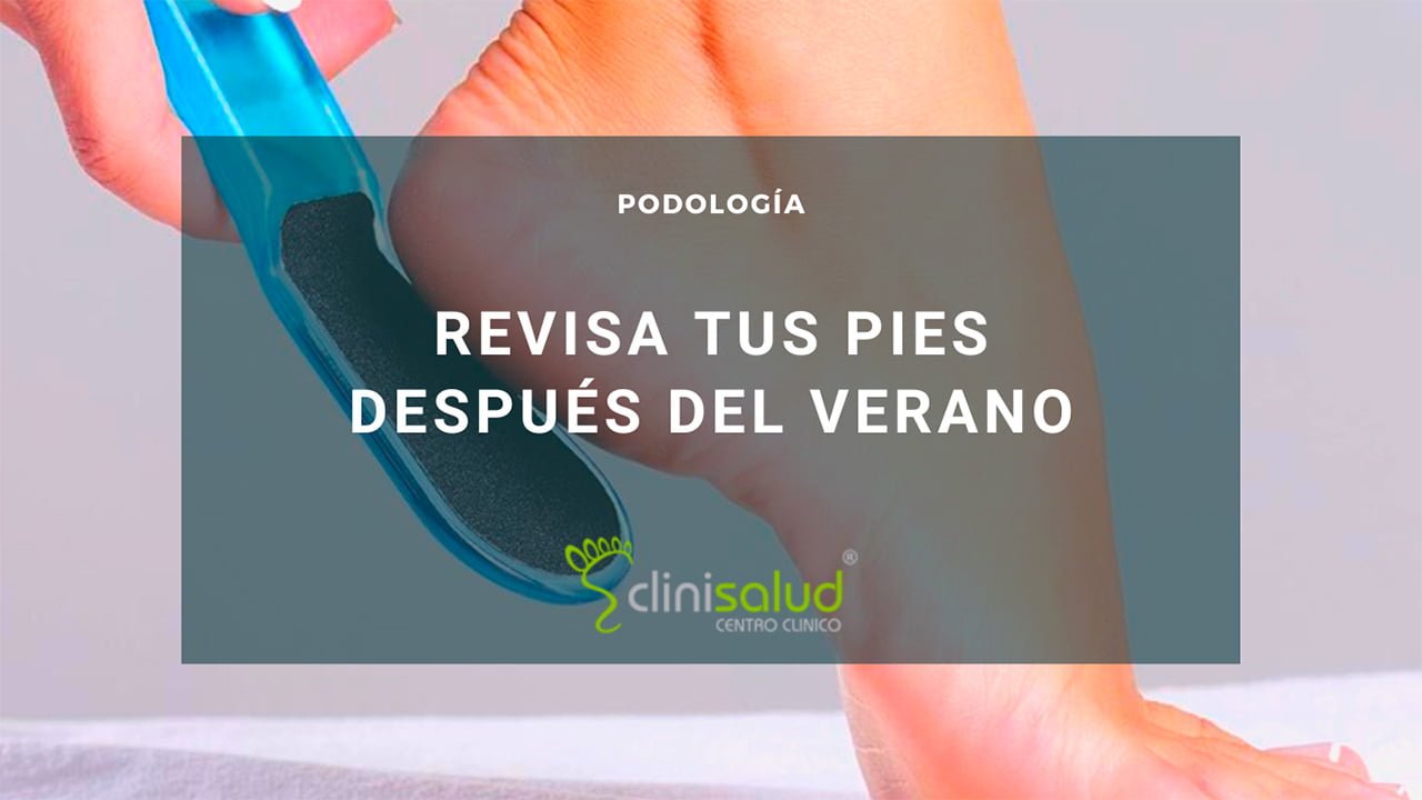 cuidado de los pies después del verano