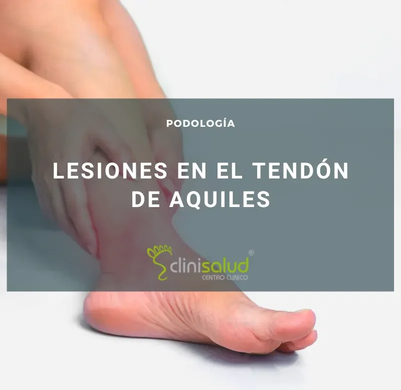 Especialistas en el tendón de Aquiles