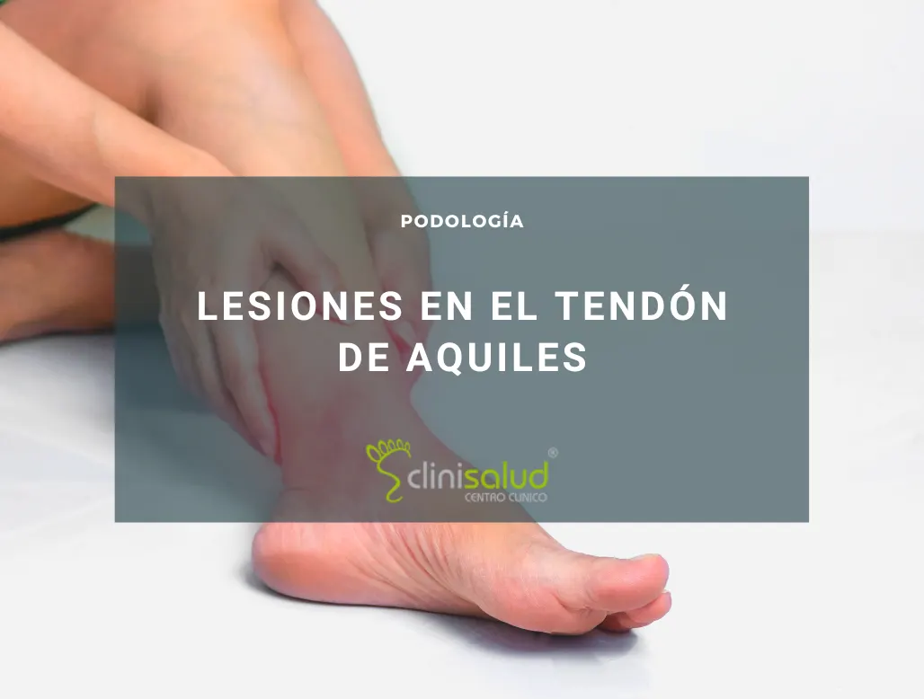 Especialistas en el tendón de Aquiles