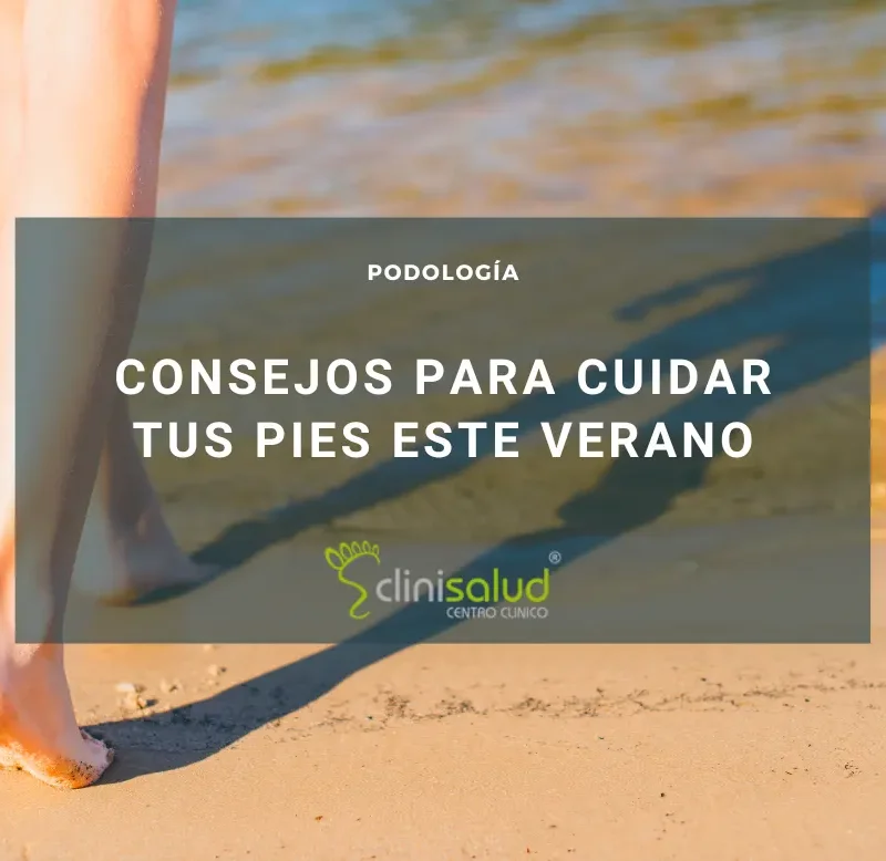 Problemas en los pies durante el verano