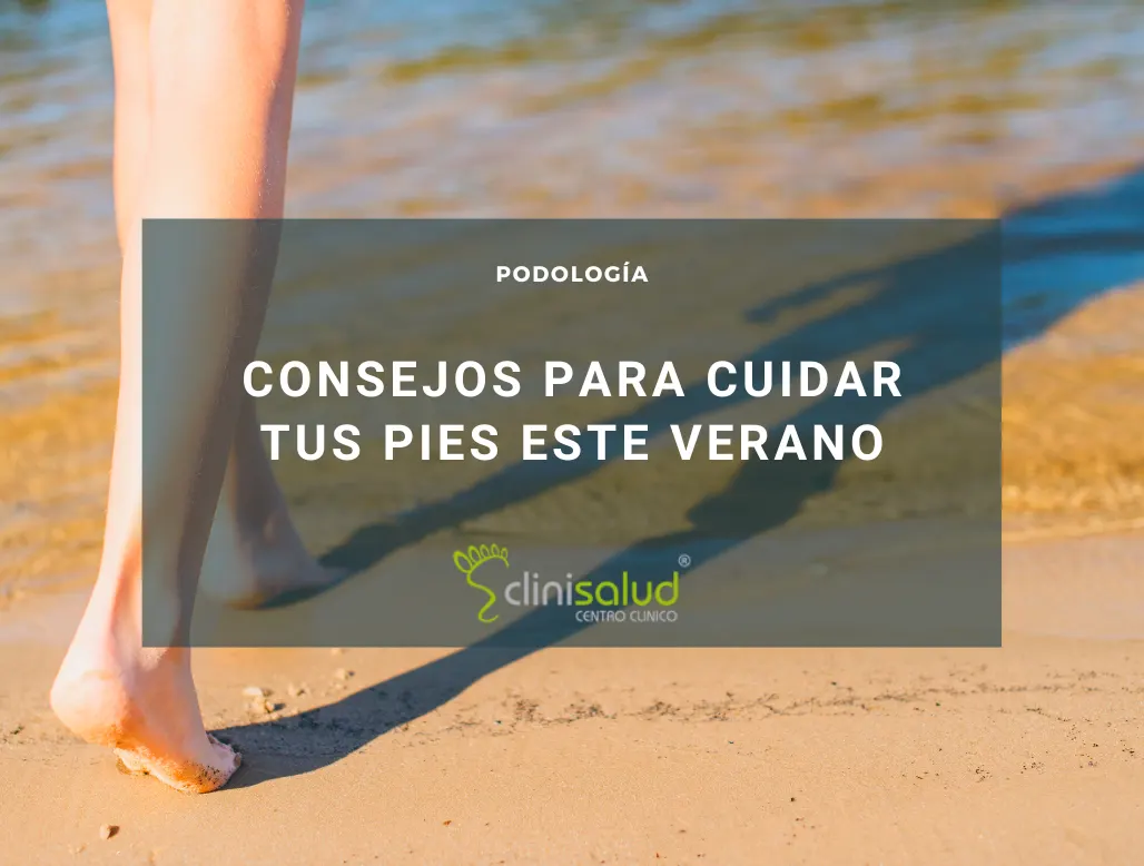 Problemas en los pies durante el verano