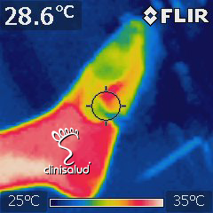 TERMOGRAFIA CLINICA