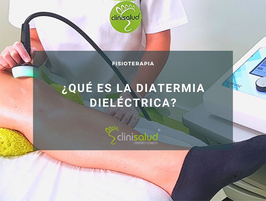 Diatermia dieléctrica