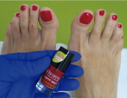 Uñas y quimioterapia Albacete