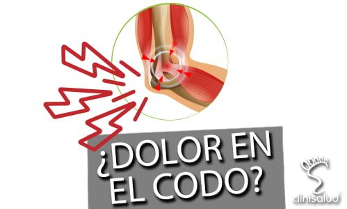 Epicondilalgia - dolor en el codo - Fisioterapia Albacete