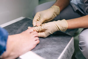 Cuidar uñas tras quimioterapia