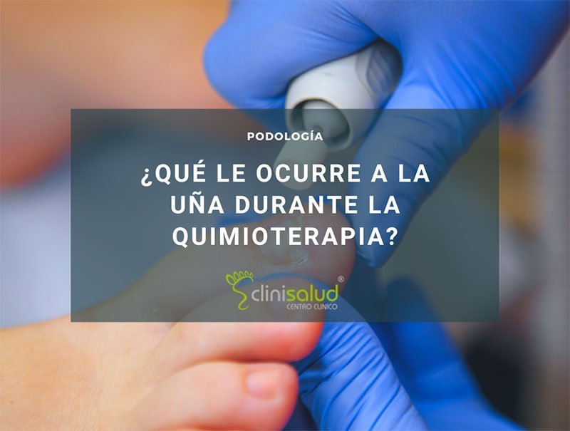 tratamiento uñas quimioterapia
