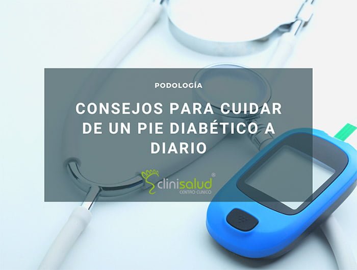 Consejos para cuidar un pie diabético