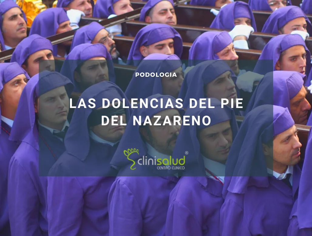 dolores del pie de nazareno