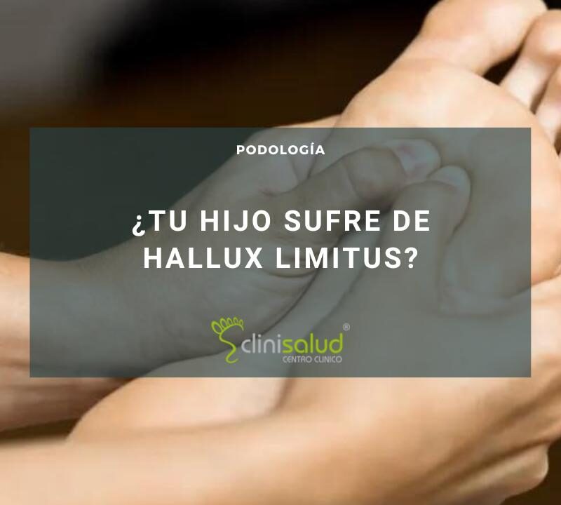 Hallux limitus en Albacete