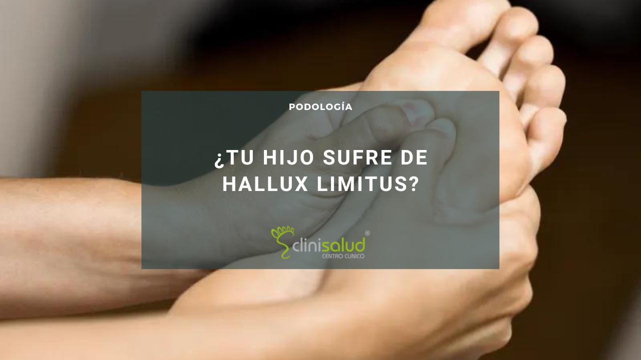 Hallux limitus en Albacete