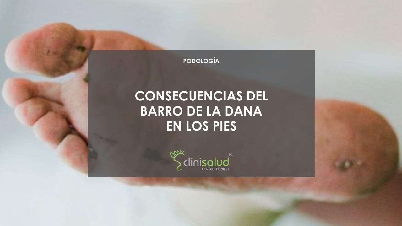 Consecuencias del barro de la DANA en los pies