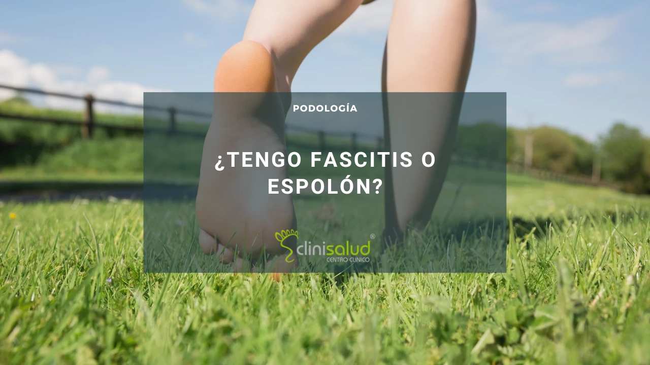 Creo que tengo fascitis